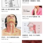 『喉に違和感』“魚の骨”が喉に刺さった！　「ご飯をかまずに丸のみ」は本当に正しいの？　