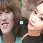 韓国の若者はなぜ「整形手術」に走るのか？ 社会を覆う見えない抑圧の正体