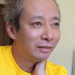 『楽しんご』、『いしだ壱成』とトルコ行き「植毛」デコを狭くする手術大成功！