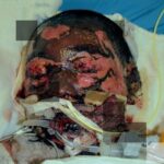 【助けて】新ＮＩＳＡ被害者の会